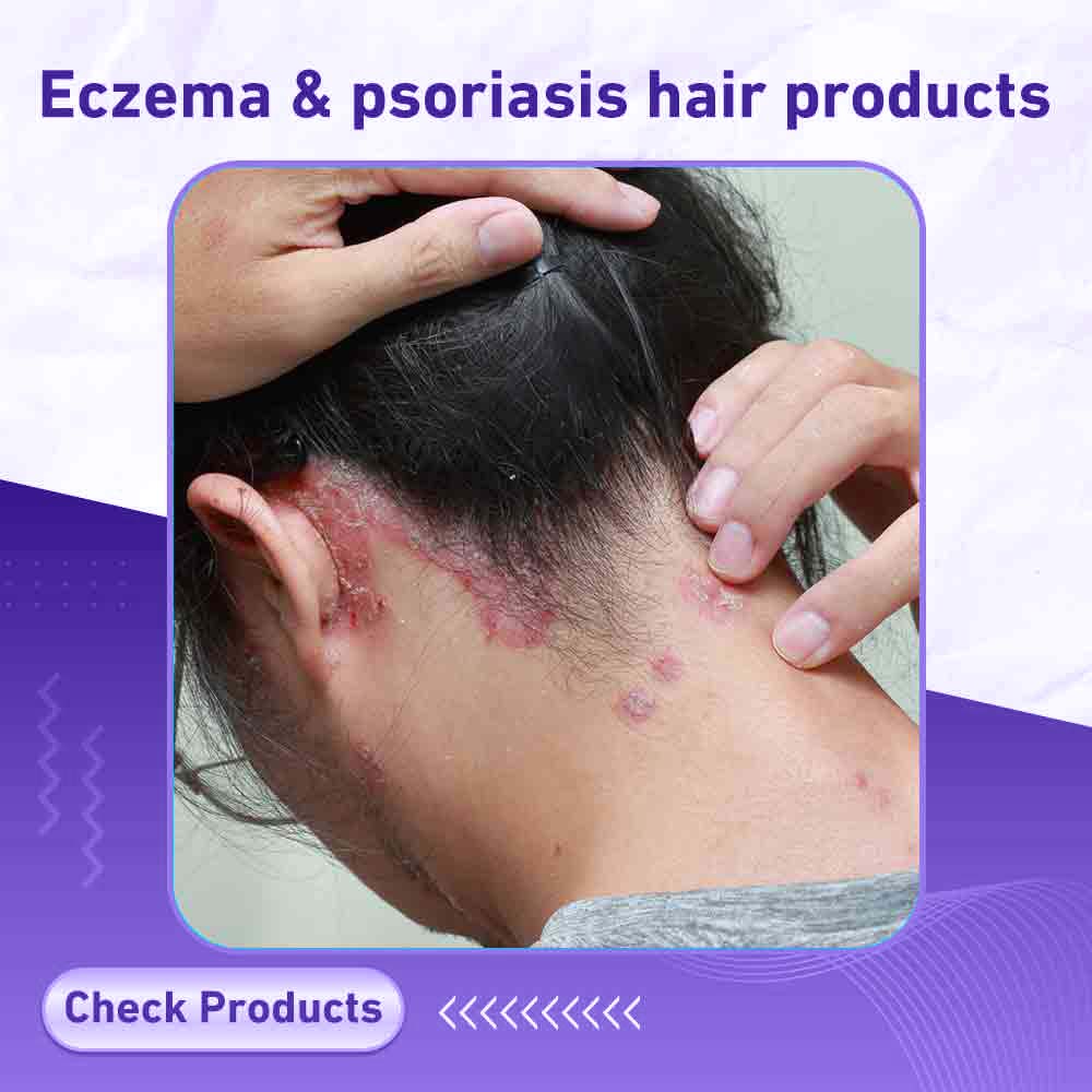 Eczema & psoriasis hair products - Berlin Pharmacy