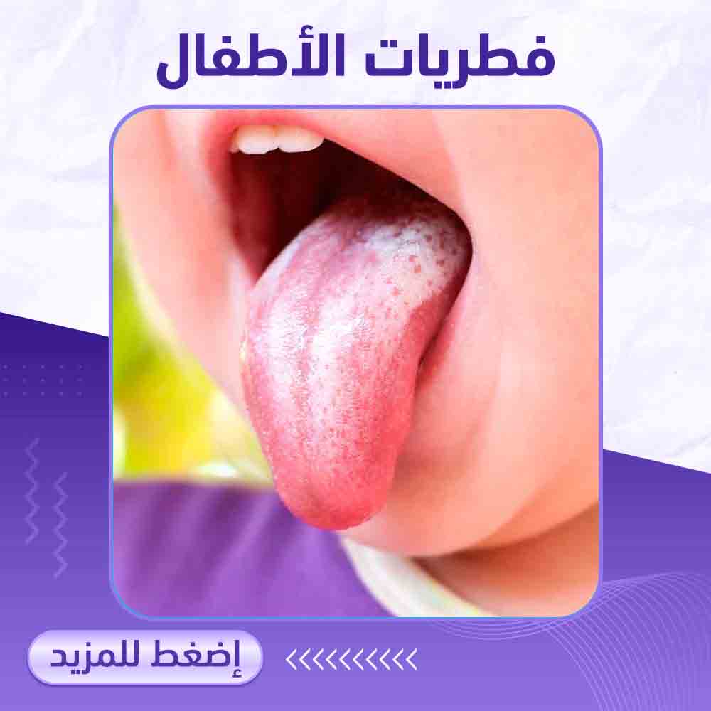 فطريات الأطفال - صيدلية برلين 