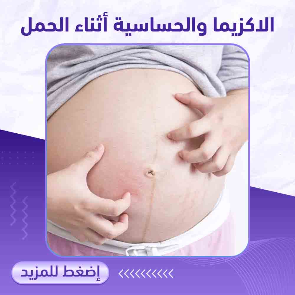 الاكزيما والحساسية اثناء الحمل - صيدلية برلين