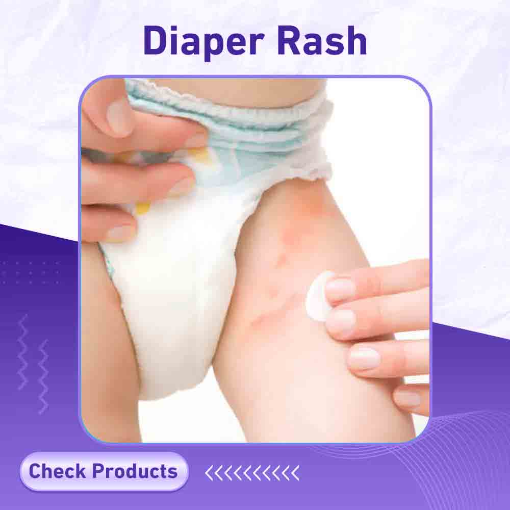 Diaper Rash - Berlin Pharmacy