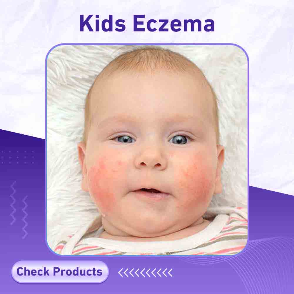 Kids Eczema - Berlin Pharmacy