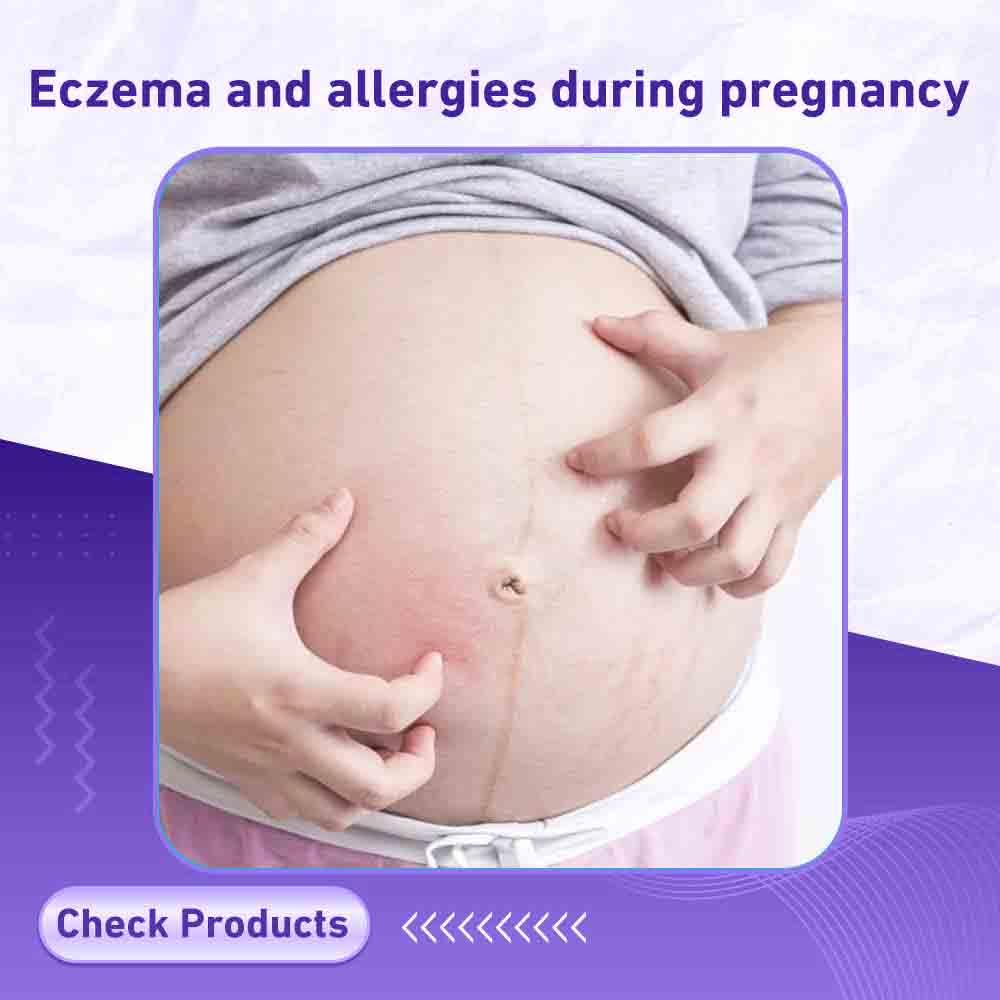 Eczema and allergies during pregnancy - Berlin Pharmacy