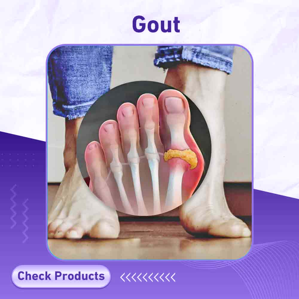 Gout Pain - Berlin Pharmacy