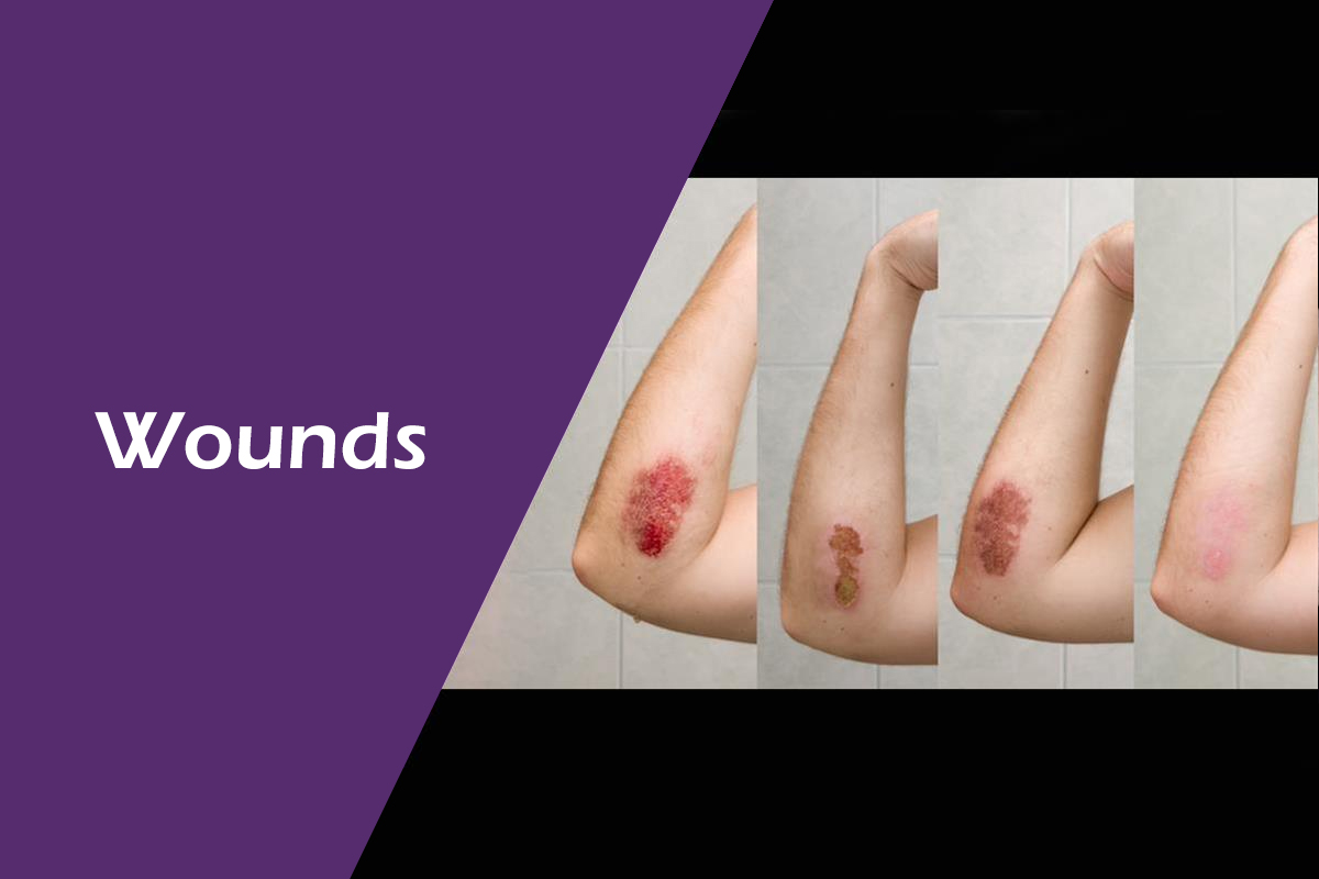 Wounds Berlin Pharmacy Online Pharmacy Kuwait